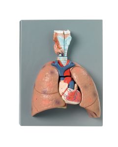 Human Lung Model