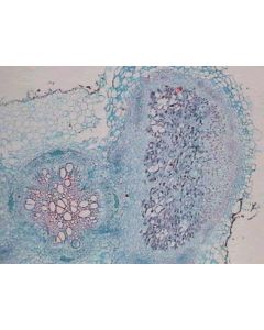 Prepared Microscope Slide - Rhizobium Leguminosarum Section