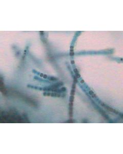 Prepared Microscope Slide - Nostoc Filament 