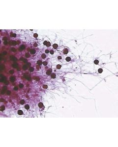 Rhizopus stolonifer W.M. With Sporangia