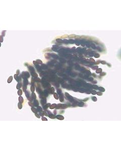 Saccharomyces cerevisae W.M. Budding Cells