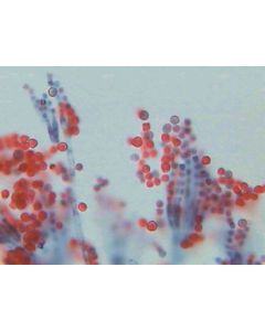 Penicilliumon Diosubstrate with Hyphae and Conidiospores.