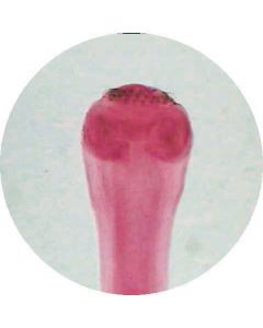 Tapeworm (Taenia pisiformis) W.M. Cysticercus Scolex
