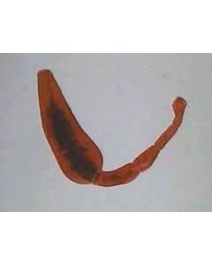 Tapeworm (Echinococcus granulosus) W.M. Complete