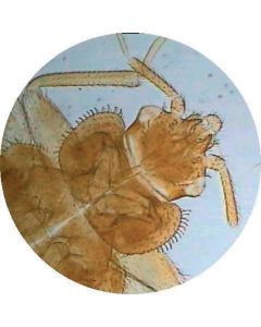 Bed Bug (Cimex lectarius) W.M.