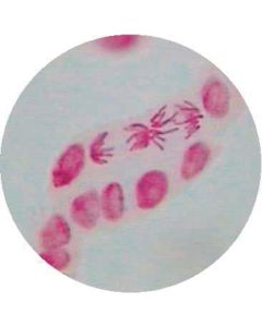 Onion (Allium) Root Tip Squash (Feulgen Acetic-Orcein Stain)