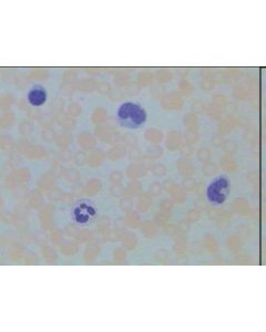 Human Blood (Stained for Red Blood Cells)