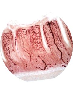 Small intestine