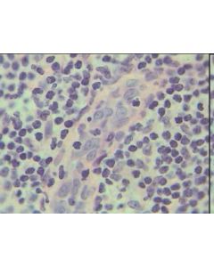 Adrenal Gland T.S. Cortex and Medulla