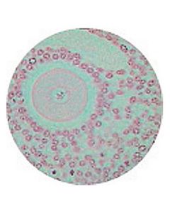 Kidney V.S. Thin Sec. (Plastic Embedded)