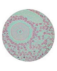 Kidney V.S. (P.A.S. and Haematoxylin Stain)