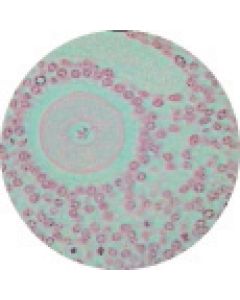 Ovary T.S. (Plastic Embedded)
