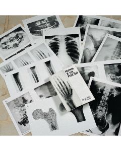 Human X-Ray Print Set - A3