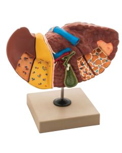 Liver Pathologies Model