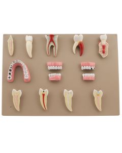 Dental Disease Set of 14