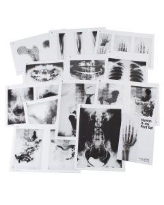 Human X-Ray Print Set - A4
