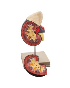 Kidney Model