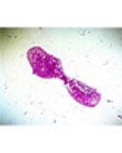 Bacterial Slide Set