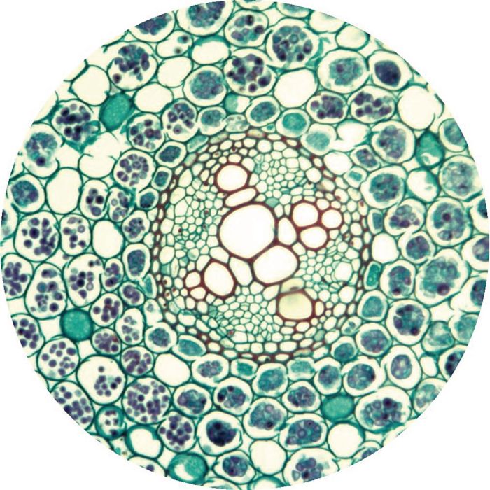 Buttercup (Ranunculus) T.S. Root Plastic Embedded