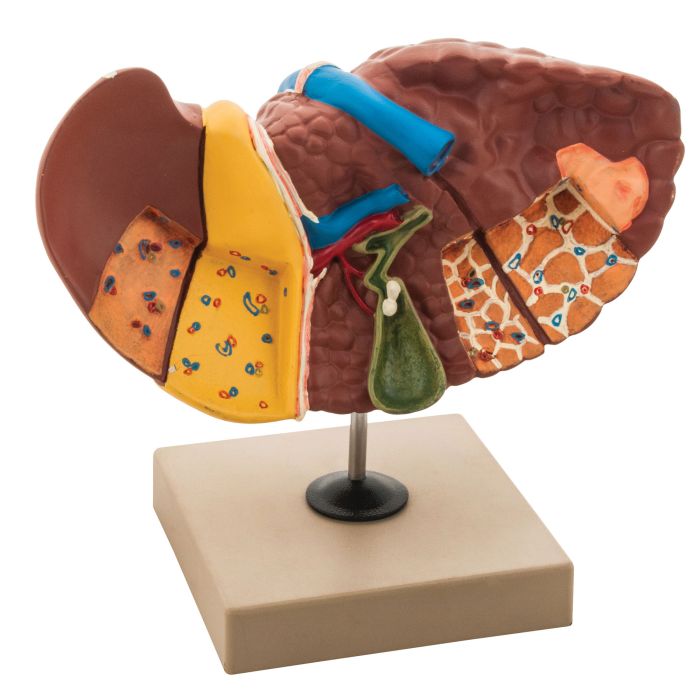 Liver Pathologies Model Liver Pathologies Model