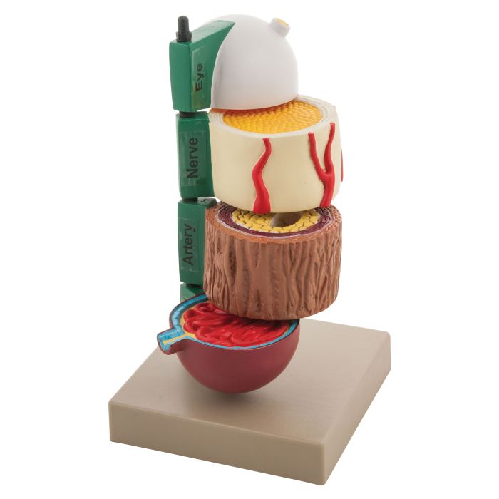 Diabetes Model Set of 4 Diabetes Model Set of 4