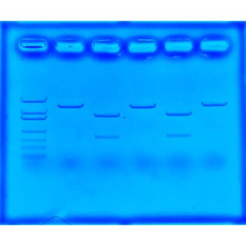 Using CRISPR to Treat Cystic Fibrosis