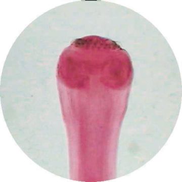 Tapeworm (Taenia pisiformis) W.M. Cysticercus Scolex