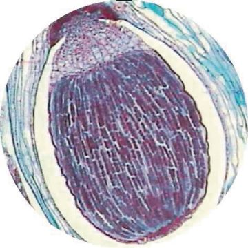 Moss Leaf W.M.