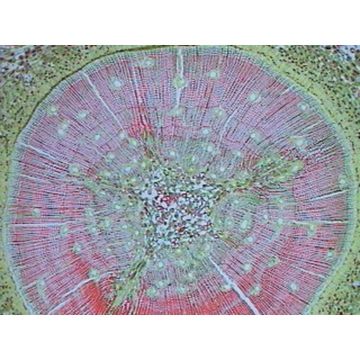 Pine (Pinus) T.S. Leaf