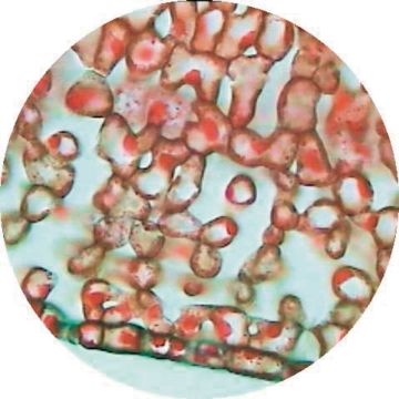 Buxus (or alt. Dicot) W.M. Lower Epidermis With Stomata