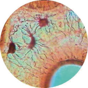 Prepared Microscope Slide - Intestine - Simple Columnar Epithelium