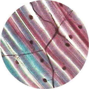 Spinal Cord C.S.
