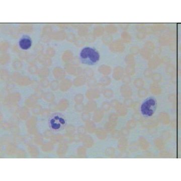 Human Blood Smear Giemsa Stained