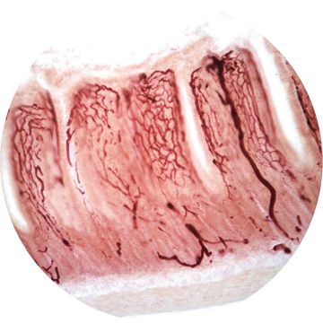 Small intestine