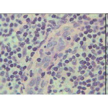Lymph Node T.S. Cortex and Medulla (Plastic Embedded)