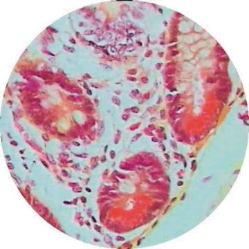 Mammal Ileum sec.