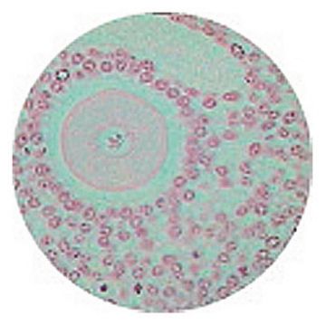 Kidney V.S. (P.A.S. and Haematoxylin Stain)