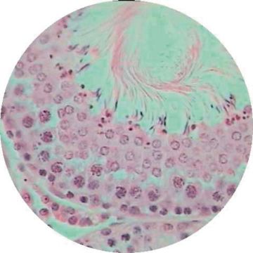 Human Spermatozoa Smear