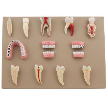 Dental Disease Set of 14