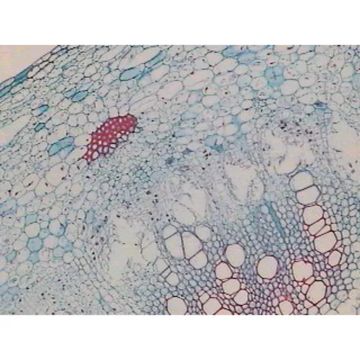 Dicot Plant Slide Set