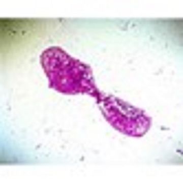 Bacterial Slide Set