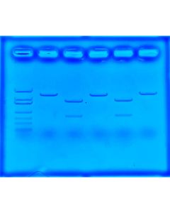 Using CRISPR to Treat Cystic Fibrosis