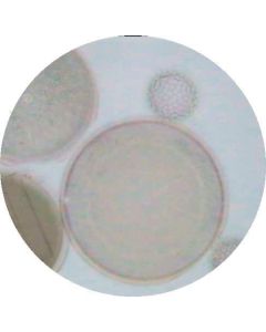 Euglena viridis (Careful Differential Haematoxylin Staining)