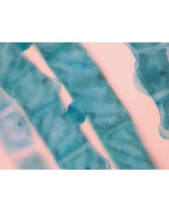 Volvox W.M. Daughter Colonies Sexual Stages Zygotes