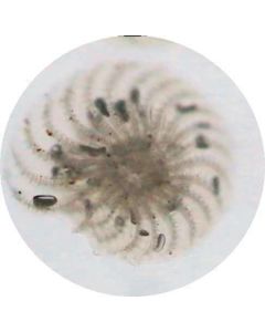 Paramecium caudatum W.M. (Careful Differential Staining)
