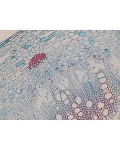 Dicot Plant Slide Set