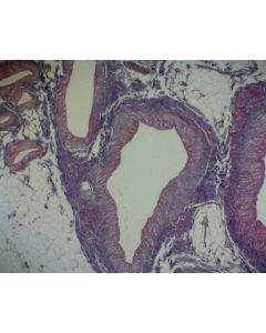 Basic Circulatory Slide Set