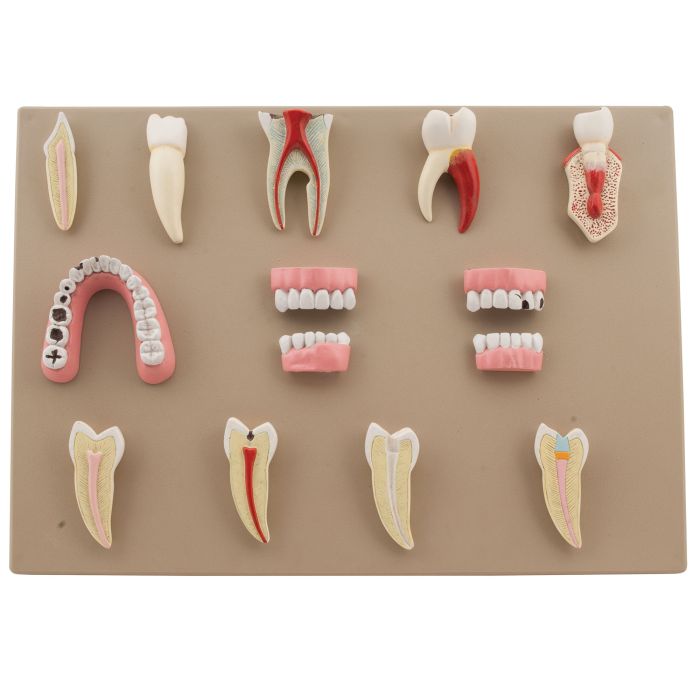 Dental Disease Set of 14