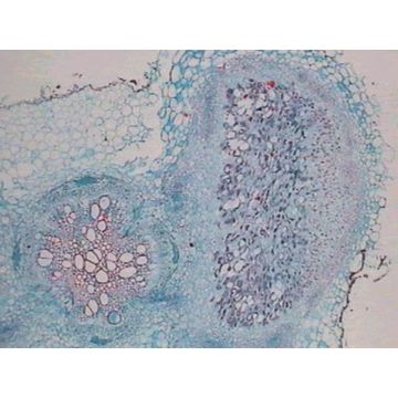 Prepared Microscope Slide - Rhizobium Leguminosarum Section