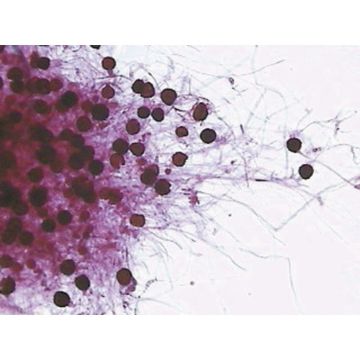 Rhizopus stolonifer W.M. With Sporangia